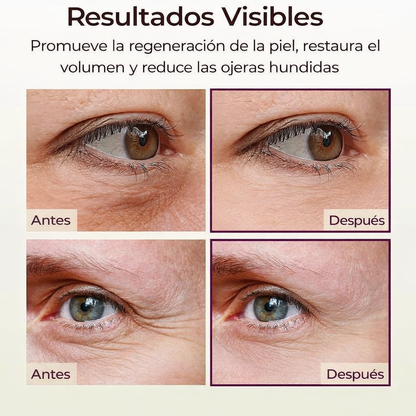 Contorno de Ojos Hidratante con Efecto Lifting para Ojeras Dr. Melaxin - Ziora™